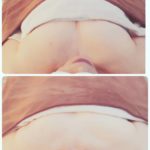 おっぱいエステ