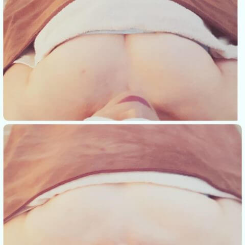 おっぱいエステ