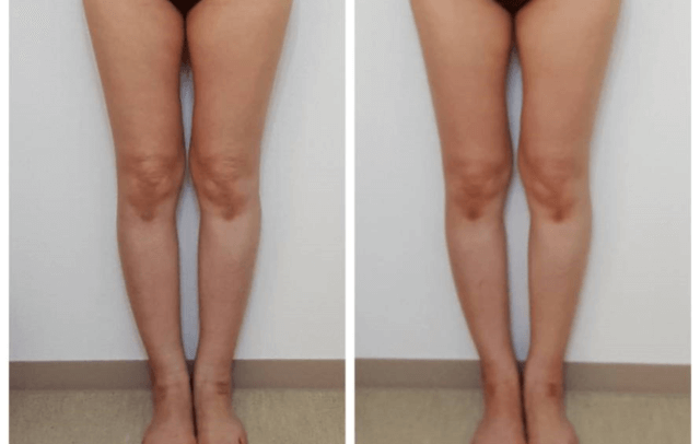 素敵な美脚ライン