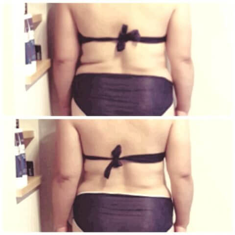 脇についた脂肪削ります