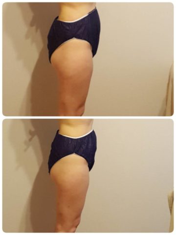 ボディスリミング研修の成果