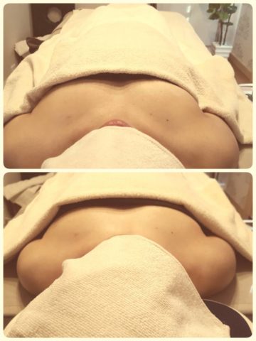 ミラクルバスト